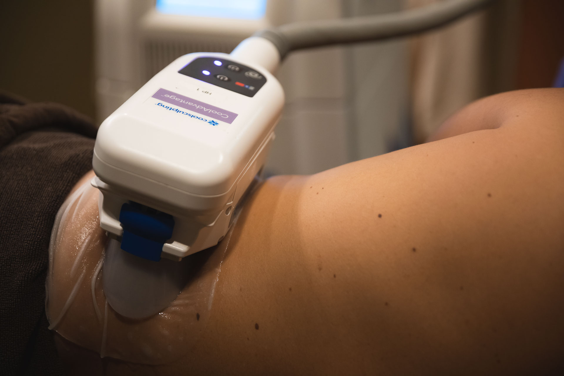 A patient gets a CoolSculpting treatment at Phases Skin Care and Laser Center