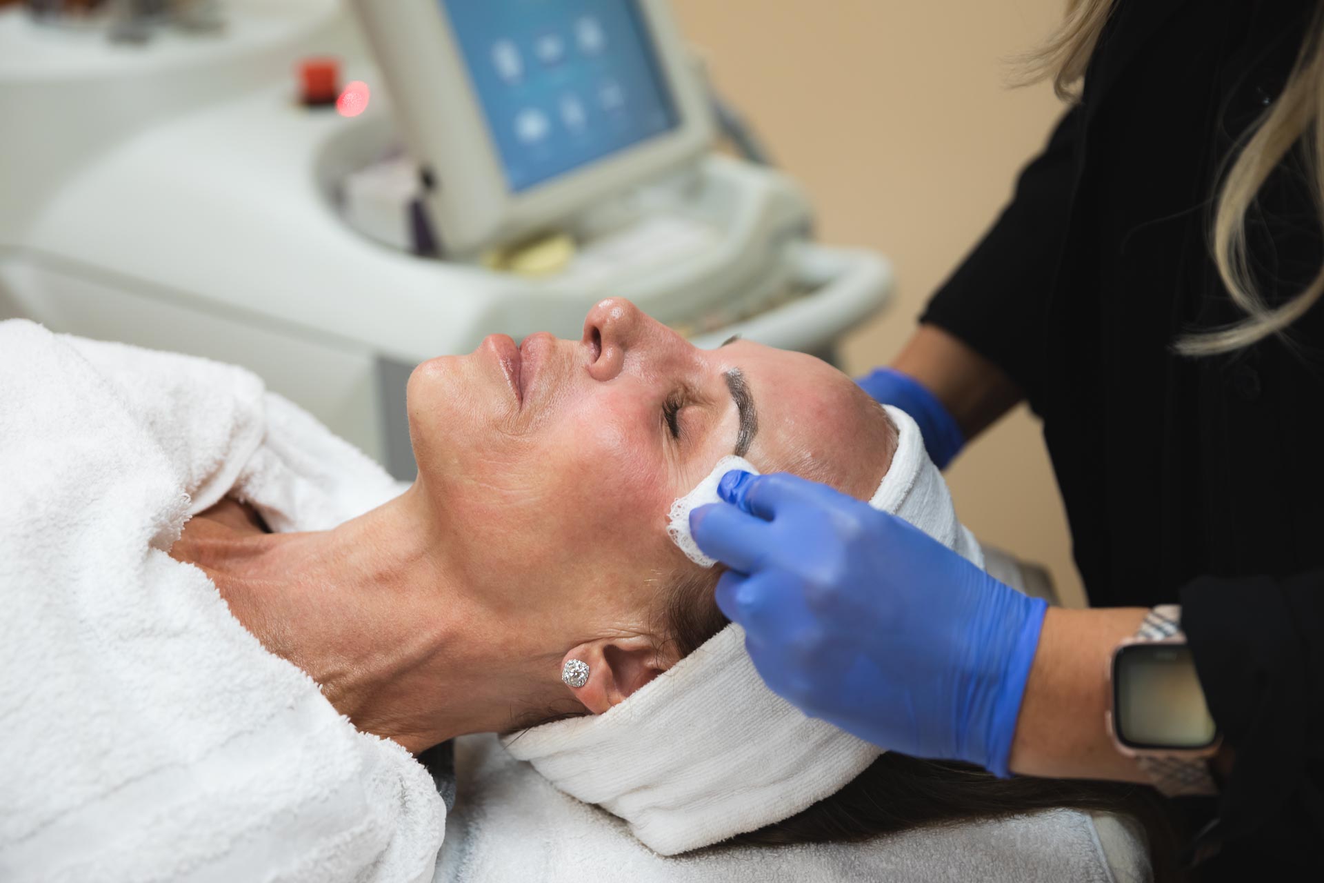 provider prepping a patient's skin for laser treatment